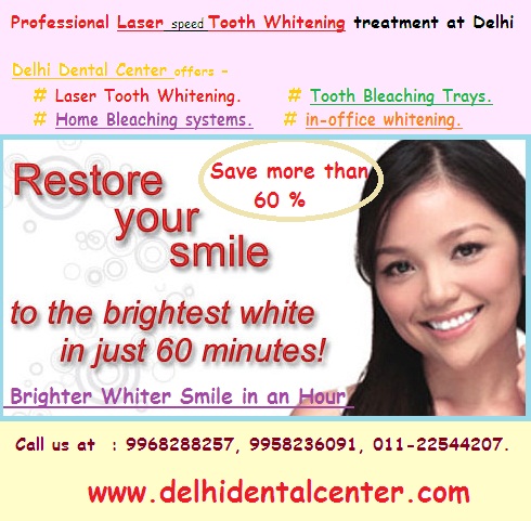 Dental Whitening Delhi Dental Center 3