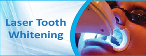 LaserToothWhitening1