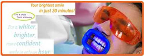 LaserToothWhitening2