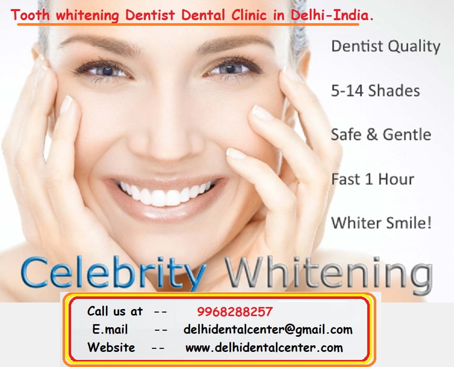 celebrity laser pearl tooth whitening treatment add promotion banner Delhi India 1