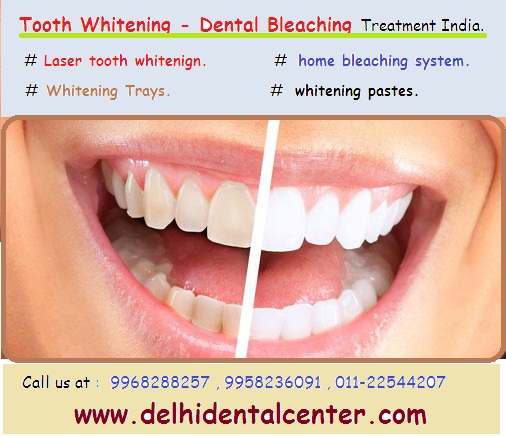 delhi dental center tooth whitening promotion banner 1