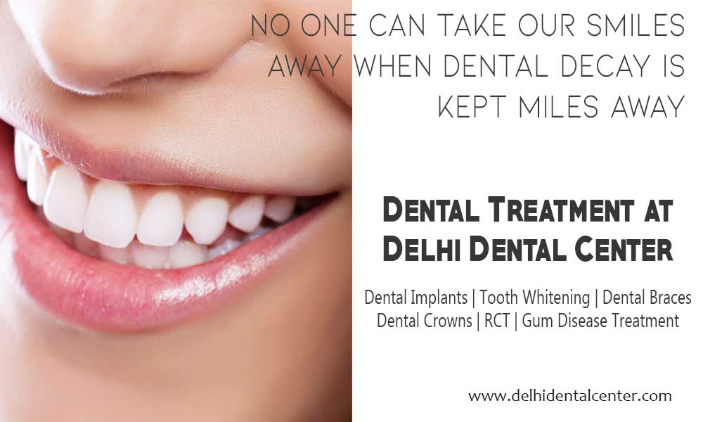 dental treatment11 1