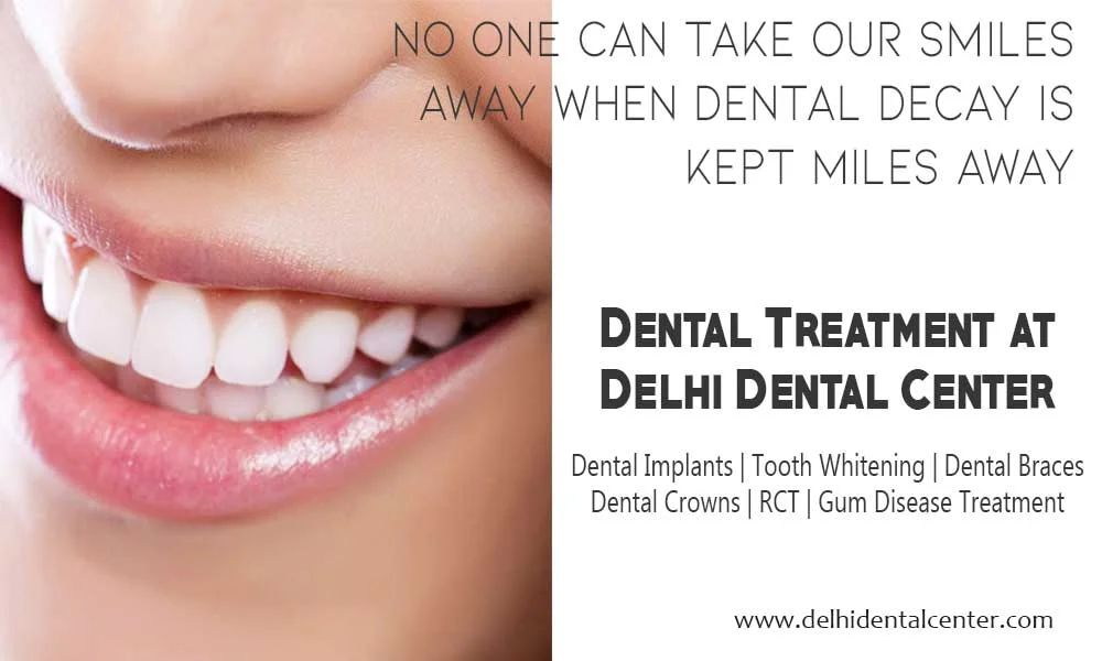 dental treatment11 1