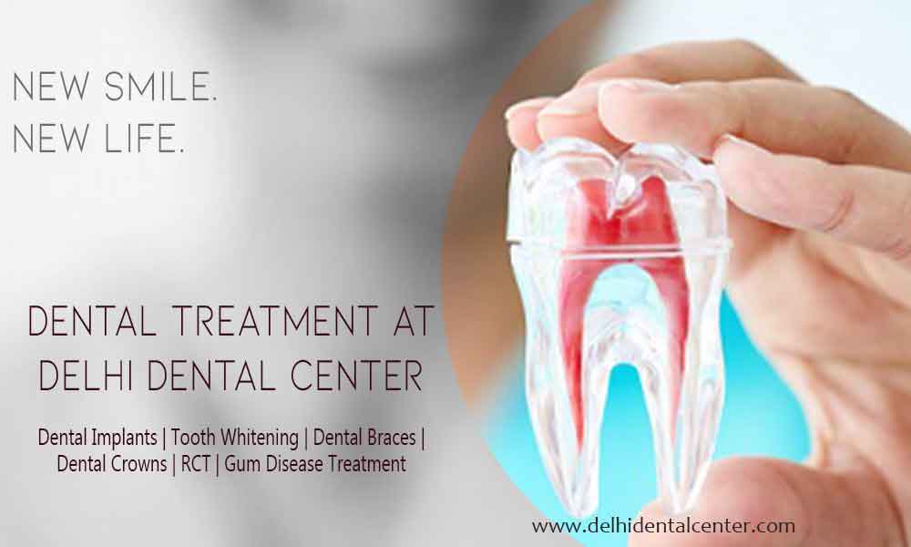 dental treatment5 1
