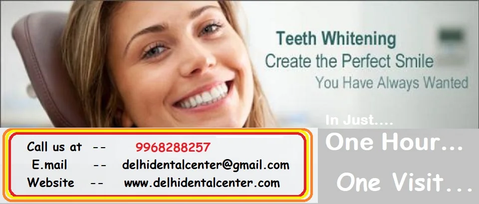 Home Tooth Whitening Dentist in Delhi 1 teeth whitening promotion Delhi Banner 1