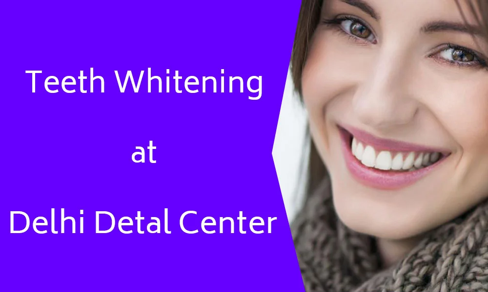 Tooth Whitening Clinic in Shakarpur 1 whitening18 apr20 4
