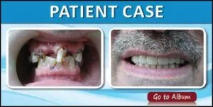 case photo for page1