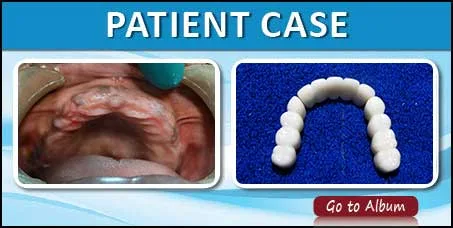 case photo for page2 1