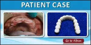 case photo for page2