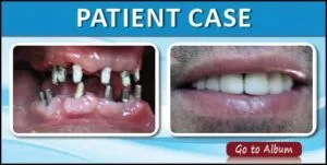 case photo for page3