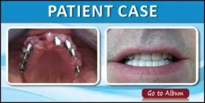 case photo for page4