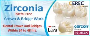 Same Day Zirconia Dental Crown Clinic in Delhi. 1 Same Day Zirconia Dental Crown Clinic in Delhi