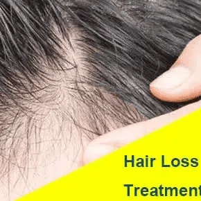 2 HAIR LOSS jpg webp