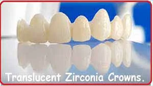 Zirconia Crown Bridge Work