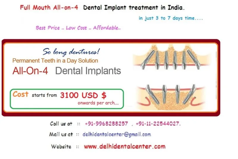 Blogs 41 3100 all on 4 treatment India. 800x536 1