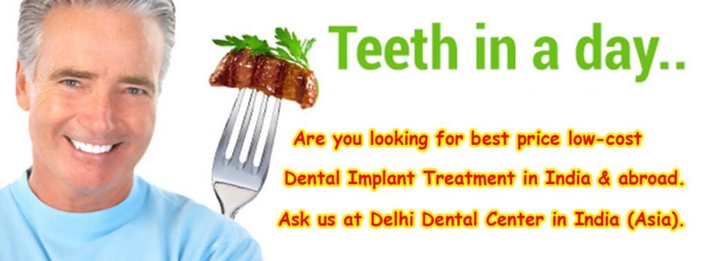 Full Mouth Dental Implant Treatment In Delhi India