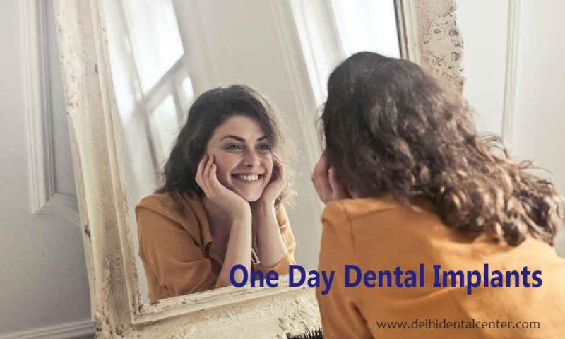 Dental Implants One Day 800x480 1