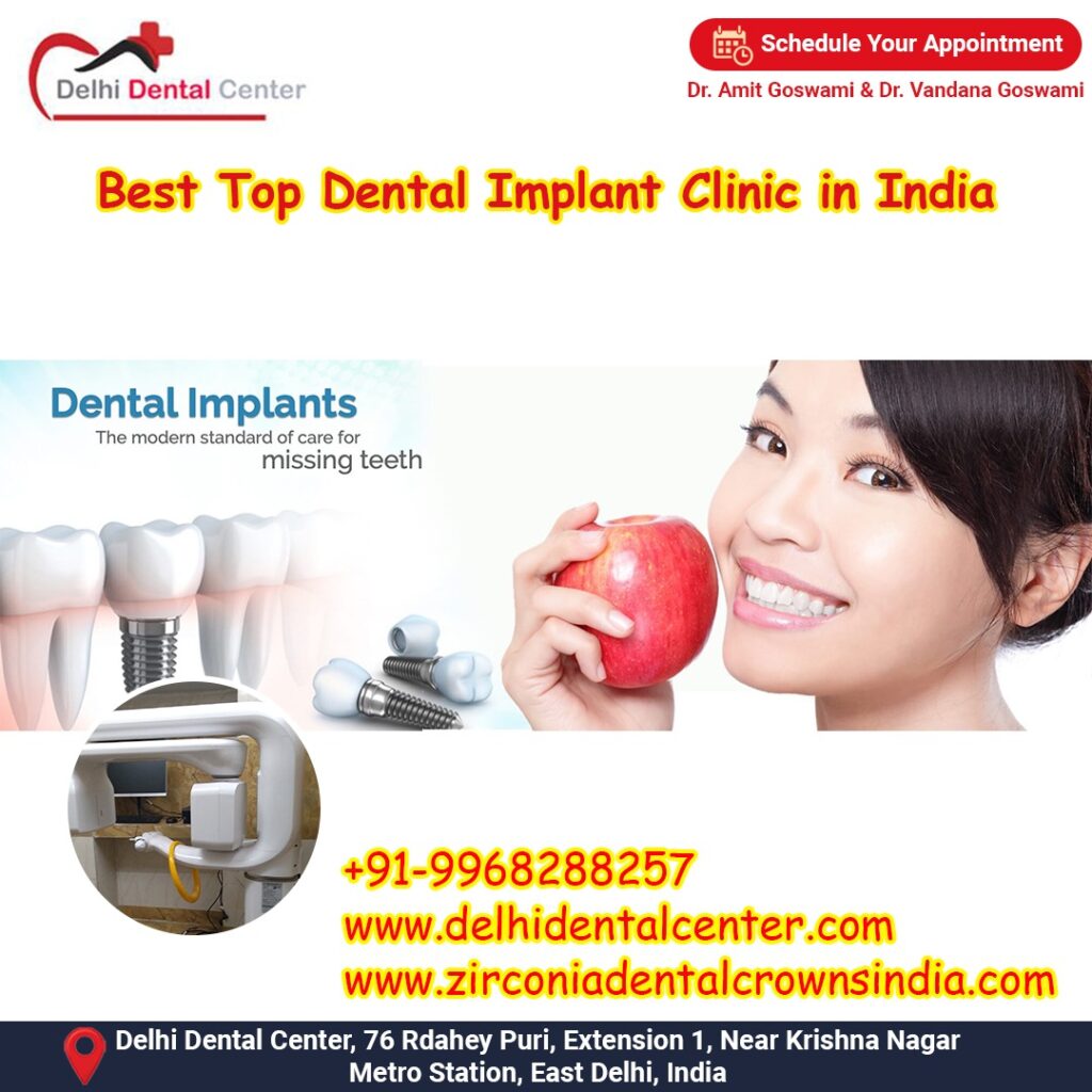 Best Top Full Mouth Dental Implant, Best Top Leading Dental Implant Specialist Dentist in India