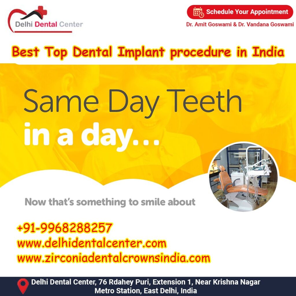 Best Top Full Mouth Dental Implant, Best Top Dental Implant Dentist in India