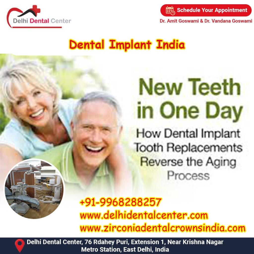 Best Top Full Mouth Dental Implant, Best Top Dental Implant Specialist Dentist, Implantologist in India