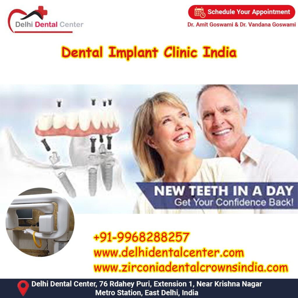 Best Top Full Mouth Dental Implant, Dental Implant Cost in India.