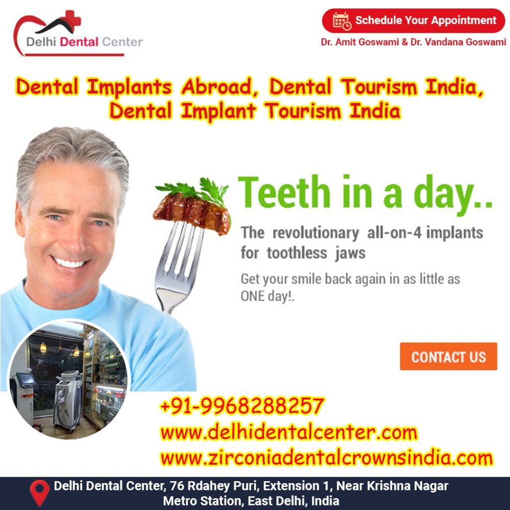 Best Top Full Mouth Dental Implant, Dental Implant Price in India.