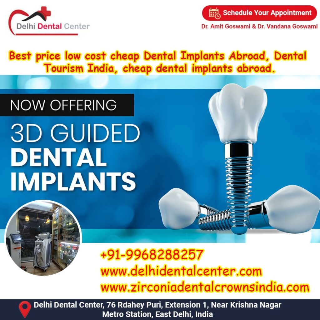 Best Top Full Mouth Dental Implant, Dental Implant Cost starts from 25,000 INR in India