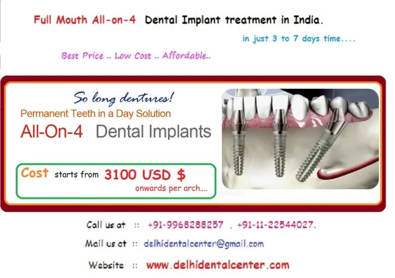 Blogs 16 all on 4 abroad cost price India banner 800x563 1