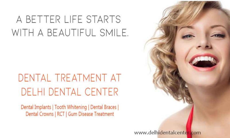 dental treatment9 800x480 1