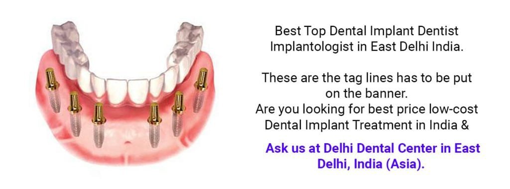Best dental implant clinic in East Delhi 1 2 1024x380 1