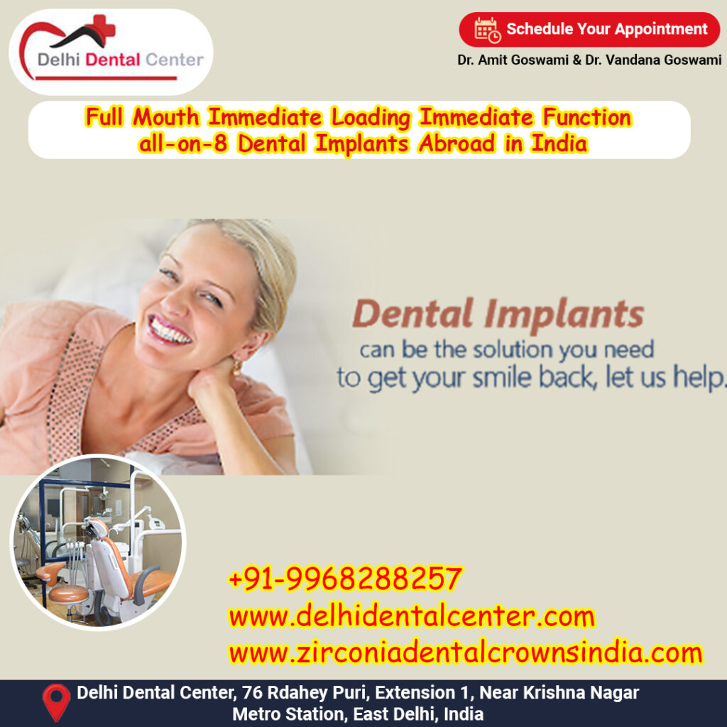 Best Top Full Mouth Dental Implant, Best Top Dental Implant Treatment in India.