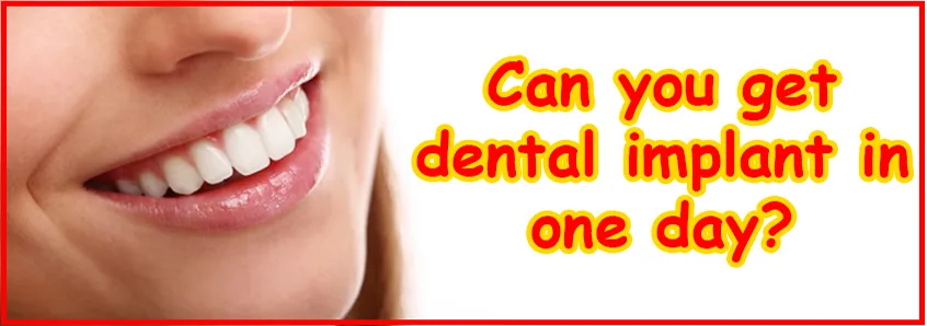 Fixed Hybrid Denture Treatment