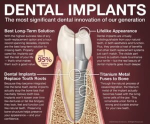 3 why Dental Implant